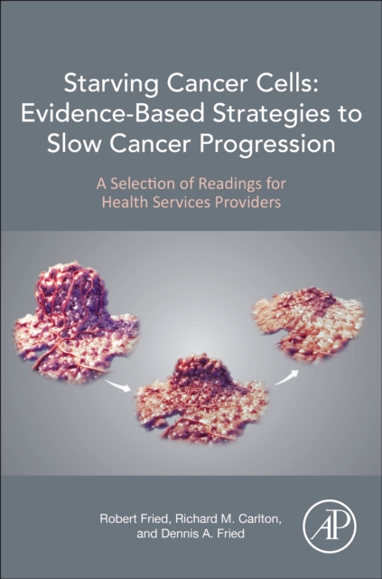 Book cover of Starving Cancer Cells: Evidence-Based Strategies to Slow Cancer Progression