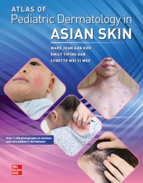 Book cover of Atlas of Pediatric Dermatology in Asian Skin