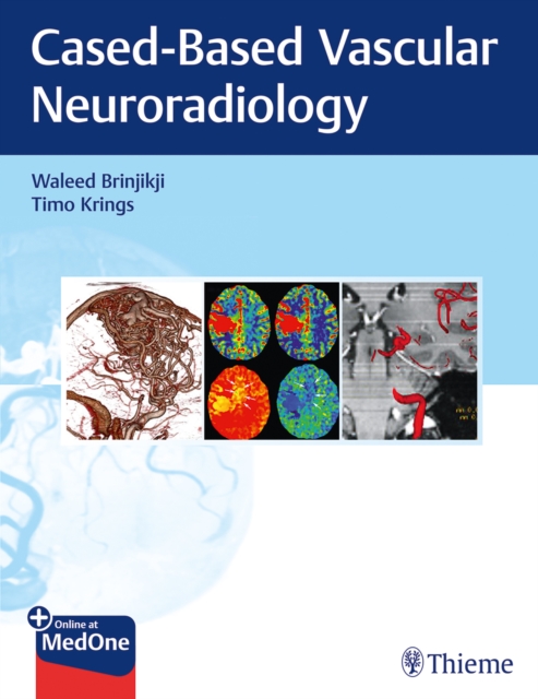 Book cover of Imaging in Neurovascular Disease