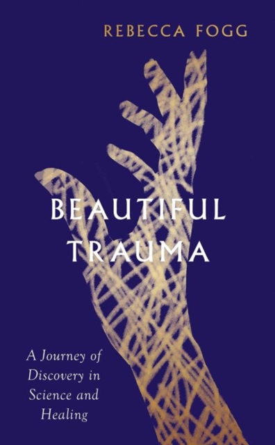 Book cover of Beautiful Trauma